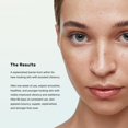 thumbnail image 3 of Crema hidratante de noche U Beauty BARRIER Bioactive 50 ml, 3 of 8