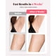 thumbnail image 4 of Depilación láser 9 Levevls Ilimitado Flash IPL Depiladora Resultados indoloros y duraderos Tratamiento de cuerpo completo para mujeres y hombres, 4 of 5
