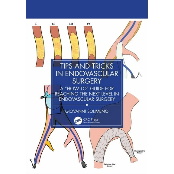 Tips and Tricks in Endovascular Surgery: A "How to" Guide for reaching the next Level in Endovascular Surgery, (Paperback)