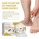 thumbnail image 5 of 1/2/3PCS 60g Bee-Venom Anti-Varicose Soothing Cream, Advanced Vitamin K Cream Reduces Swelling Varicose & Spider Veins, 5 of 5