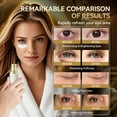thumbnail image 3 of BREYLEE Renewal Eye Serum with Coffine Niacinamide Polypeptide, Eye Care for Puffy Eye Bags Fine Lines Dark Circles Wrinkles, Anti-Puffiness & Fading Fine Lines, 3 of 7