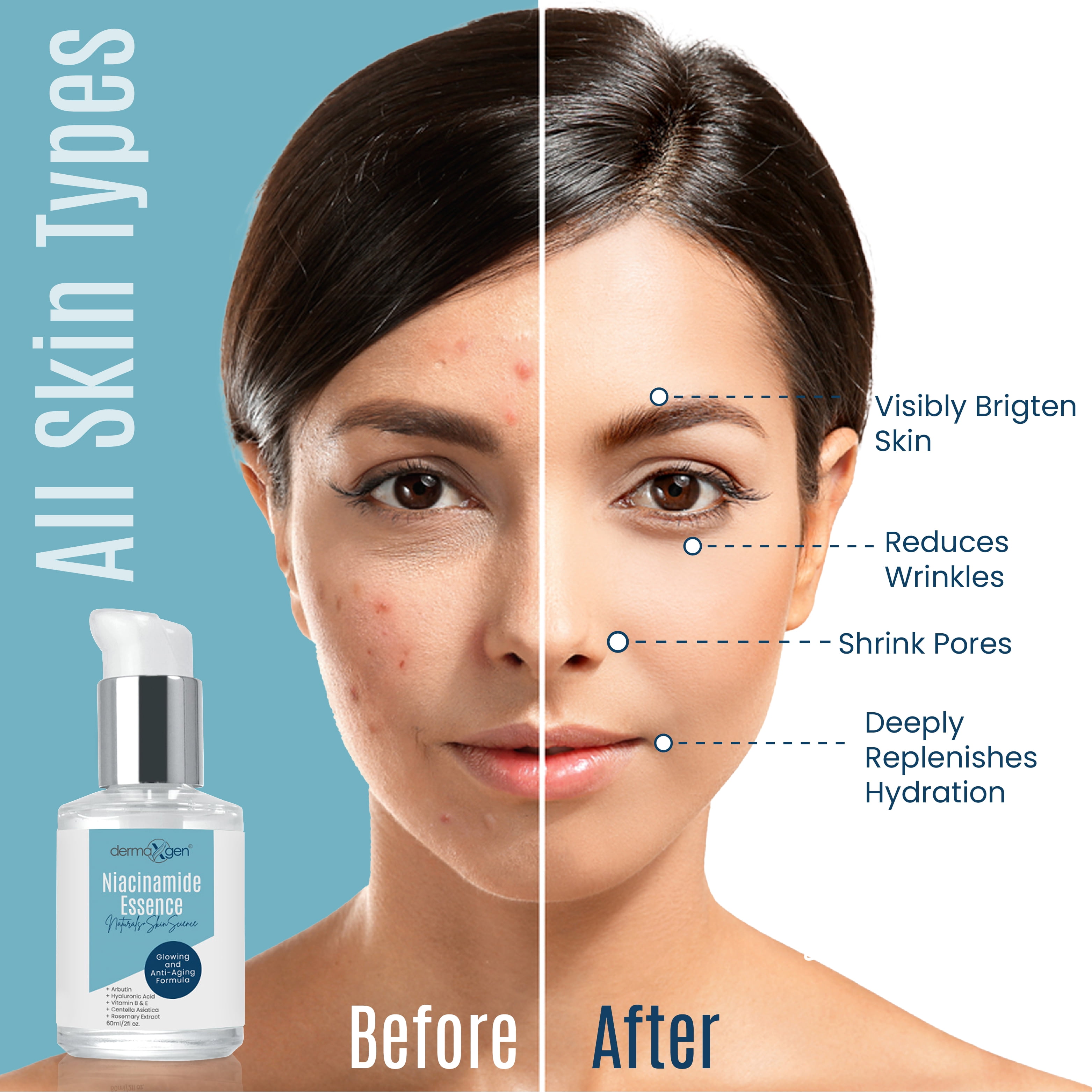 Dermaxgen Niacinamide Serum for Smooth, Bright & Youthful Skin, Pore