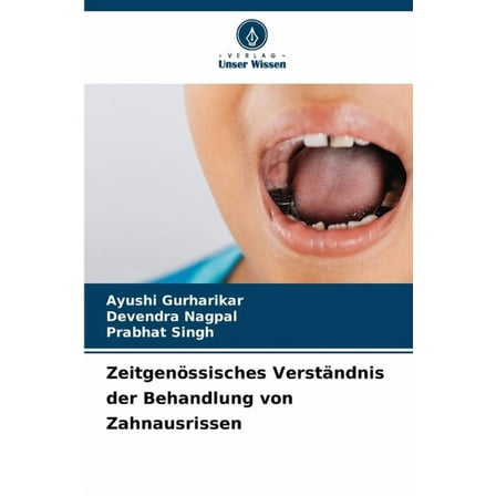 Zeitgenössisches Verständnis der Behandlung von Zahnausrissen, (Paperback)