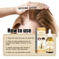 thumbnail image 3 of Nutriente Suero para el Cabello, Hidratacia Reduce El Crecimiento del Cabello de la Planta de Suero Extracció de Arroz de la Planta de Suero 4pcs 30 ml para diaramenté para, 3 of 7