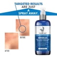 thumbnail image 4 of Bruma facial en aerosol antiarrugas Thyme Out con bakuchiol, 120 ml, 4 of 7