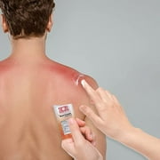 Ever Ready First Aid Antiseptic Burn Cream for Burn Pain -144 Packets