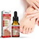 thumbnail image 3 of 10 Uds. para Uñas Encarnadas 10ml Los Pies Unisex Cuidado La Las, 3 of 8