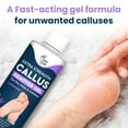 thumbnail image 6 of Foot Cure Lavender Foot Soak & Callus Remover Gel Kit - Remove Calluses with Epsom Salts, Callus Remover Gel for Dry Cracked Heels & Foot Odor, 6 of 9