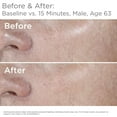 thumbnail image 7 of SkinMedica HA5 Rejuvenating Hydrator 2oz, 7 of 7