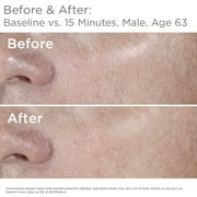SkinMedica HA5 Rejuvenating Hydrator 2oz