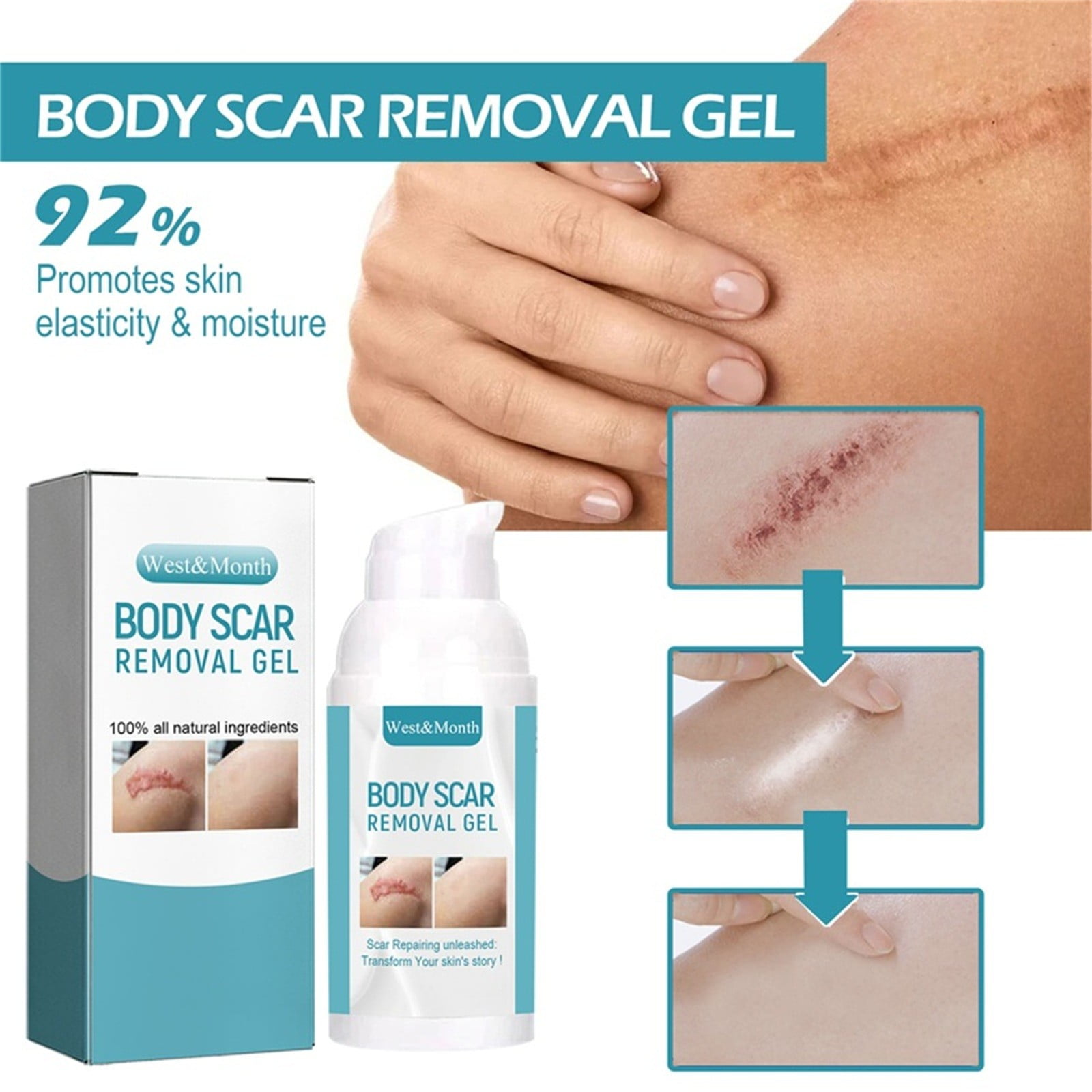 Komiseup Scar Cream, for C-Section, Tummy Tuck, Keloid, and Surgical Scars, Stretch Marks, Keloids,Scar Treatments for Old & New Scars,Scar Removal for Women Men