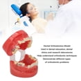 thumbnail image 3 of Modelo de Ortodoncia Soporte de Cerámica de Alambre de Metal ANGGREK 24 Dientes, 3 of 7