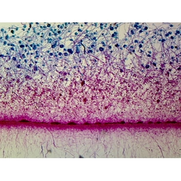 Aspergillus, Highly Aerobic Brown Mold; Whole-mount by Go Science Crazy