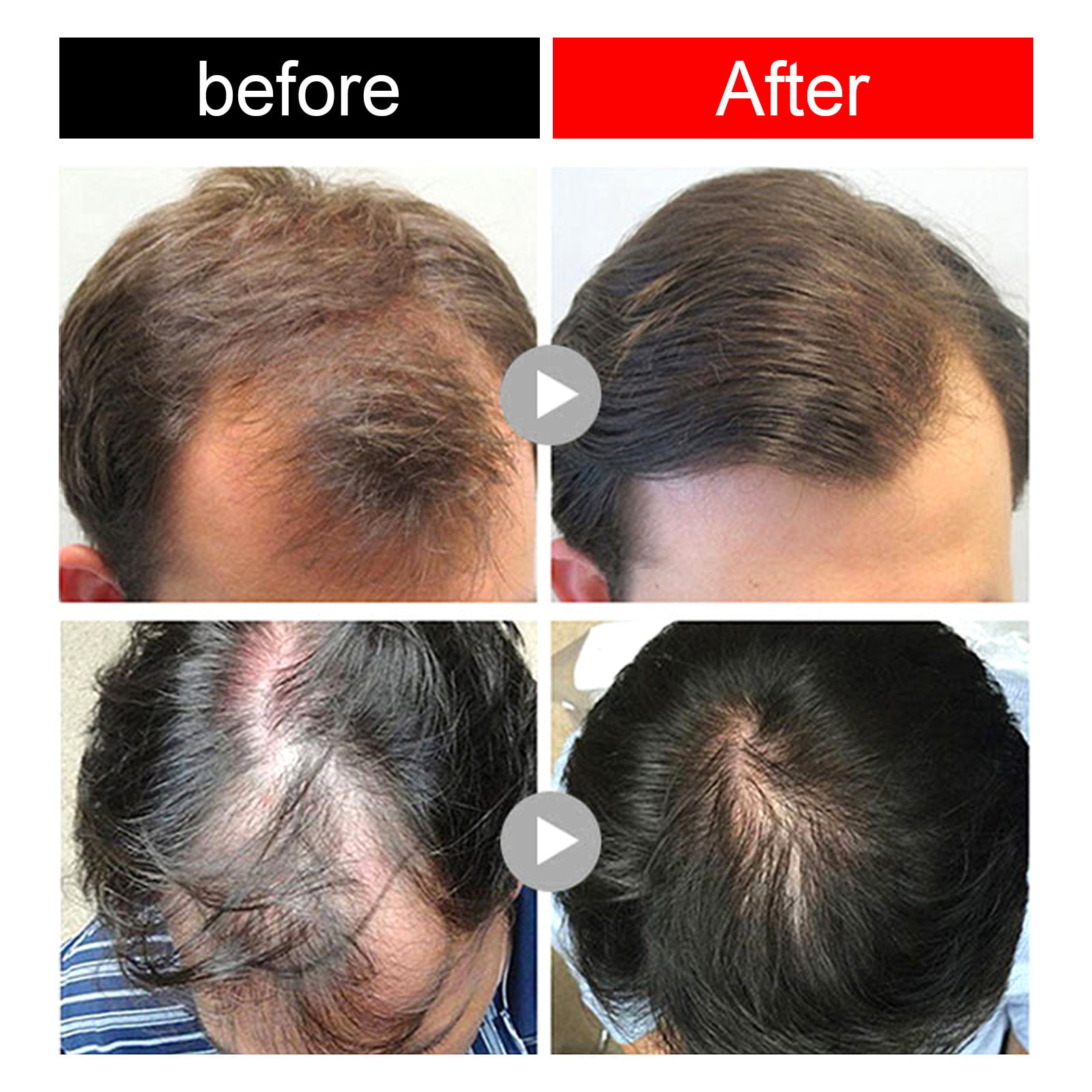 Magic Hair Growth, Increase Blood Circulation Hair Loss Scalp Cream,Hair  Loss Treatment for Women Men 