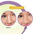 thumbnail image 3 of DR.RASHEL Bande pour le Nez Anti-Bronzage, Éliminateur de Points Noirs, 10 Bandes Chacune (Lot de 2), 3 of 4