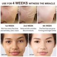 thumbnail image 5 of 3PCS Retinol Cream Whitening Remove Melasma Acne Pigment Dark Spot Pigment Face Serum NEW, 5 of 5