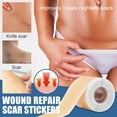 thumbnail image 3 of 2-3 de paquete Hojas de cicatrices Yuyangstore Cintas de tratamiento Silicona suave 2 piezas, 3 of 8