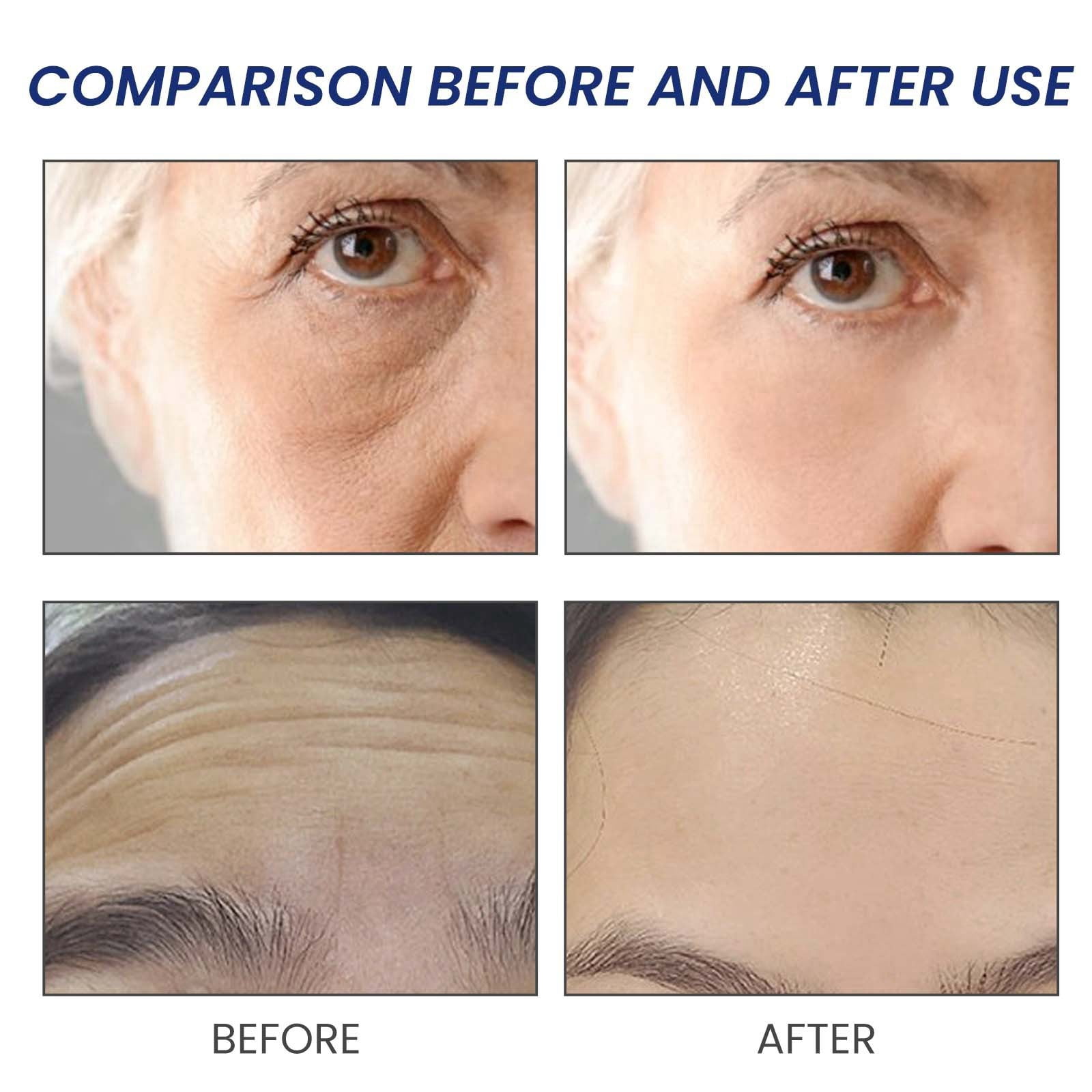Younger Skin Organic Skin Solution Remover Plumper Skin for Face Lip Suction Plumper Glow Moisturizer Lip Gloss Filler compatible with Machine Revision Tinted Moisturizer Jawline Snow