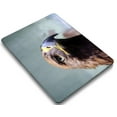 thumbnail image 4 of KSK KAISHEK Hard Shell for New MacBook Air 13" with Retina Display and Touch ID USB Type-C Model: A2337 m1&A2179&A1932 (Feather Series 0622), 4 of 5