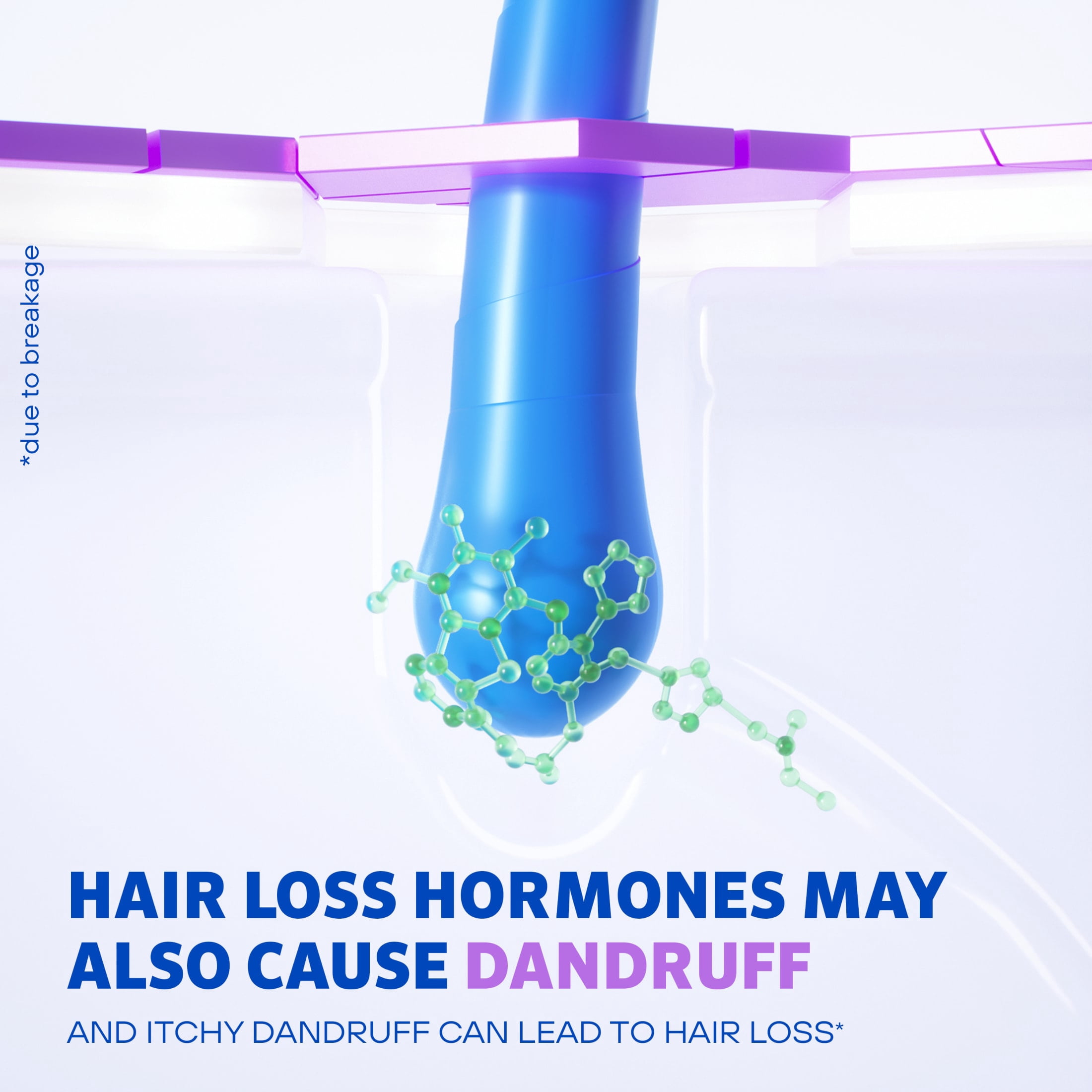 Men's Rogaine Anti-Dandruff 2 in 1 Shampoo + Conditioner, 8.4 fl. oz