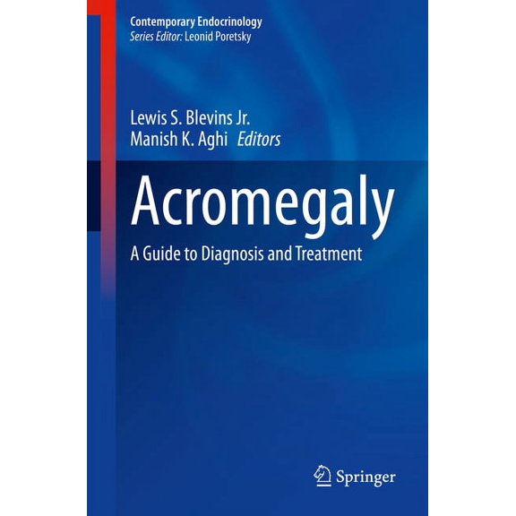 Contemporary Endocrinology Acromegaly: A Guide to Diagnosis and Treatment, (Hardcover)