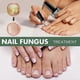 thumbnail image 3 of Líquido reparador de uñas 3X Extra Strength Solución para uñas de los pies y uñas de los pies Reparación de uñas dañadas y descoloridas Suministros naturales, 3 of 5