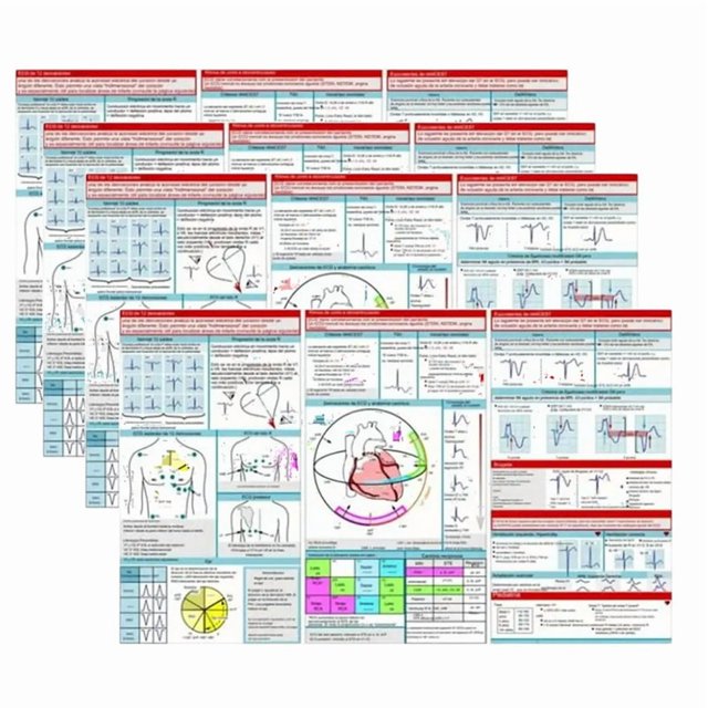 Guide de Poche EKG Interprétation Carte de Poche Disposition Horizontale & Verticale Guide de Référence Compact pour Usage Hospitalier, 4 * Guide de Poche EKG