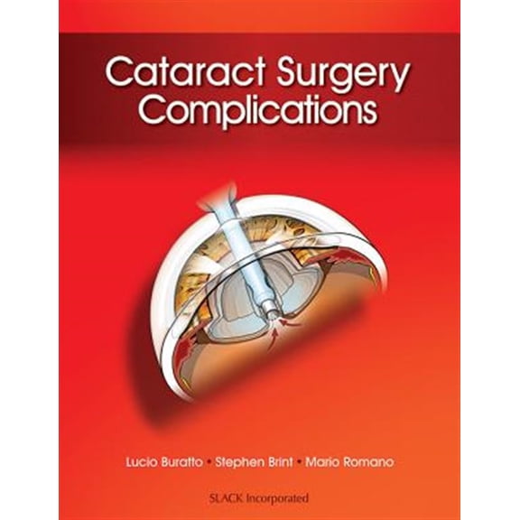 Pre-Owned Cataract Surgery Complications (Hardcover)