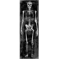 thumbnail image 2 of Wagner, Martin 9x18 Black Ornate Wood Framed with Double Matting Museum Art Print Titled - Skeleton II, 2 of 4