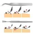 thumbnail image 7 of Cheers.US 1 Set Tick Remover Tool Set Stainless Steel Tick Remover Kit for Cats and Dogs Grooming Supplies for Puppy, 7 of 7