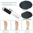 thumbnail image 2 of 4 Pcs Pedicure Rasp Dead Skin Remover Double Sided Foot Scrubber Heel Scraper Foot Scrub Care Tool, 2 of 5