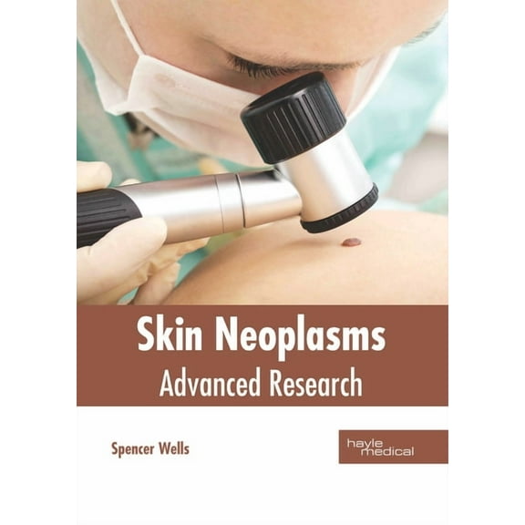 Skin Neoplasms: Advanced Research, (Hardcover)