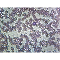 Iron-Deficient Anemia Blood (Human); Smear; GS Stain; Showing Peripheral Blood Film with Small, Pale Red Blood Cells by Go Science Crazy