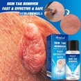 thumbnail image 1 of IBeaLee Cross border Wart Removal Liquid, Youfu Flat Liquid, Huangzi Point Mole Liquid, Chicken Eye Filament Flat Youde Removal Liquid, 1 of 5