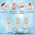 thumbnail image 3 of Mesotherapy Multi Needle 20PCS 5 Pin 32G 1.5MM, 3 of 5