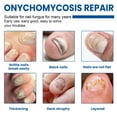 thumbnail image 4 of Parches de hongos de uñas XIMONTH 32 parches para hongos en las uñas de los pies dañadas, nutritivos, hidratantes, reparadores de uñas de los pies, 4 of 8