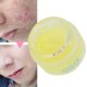 thumbnail image 4 of Crema hidratante para pieles claras, 30 g, tratamiento para controlar la grasa y las marcas de acné, 4 of 8