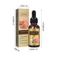 thumbnail image 3 of Coconut oil Essential oils Skin Moss Oil Skin Itching, Stop Itching, Swelling, Hand And Foot Moss External Care Oil（30ml） Essential(buy 2 get 10% off), 3 of 5