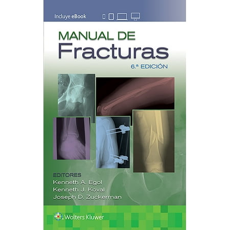 UPC: 9788417949440 | Manual de Fracturas (Edition 6) (Paperback)