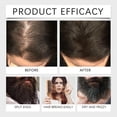thumbnail image 5 of HHBEAUTY Mens Beard Oil - Subtle Fragrance - Deeply Moisturizes and Softens Your Beard and Adds a Natural Shine - Naturally Derived with Shea Butter and Argan Oil, 5 of 9