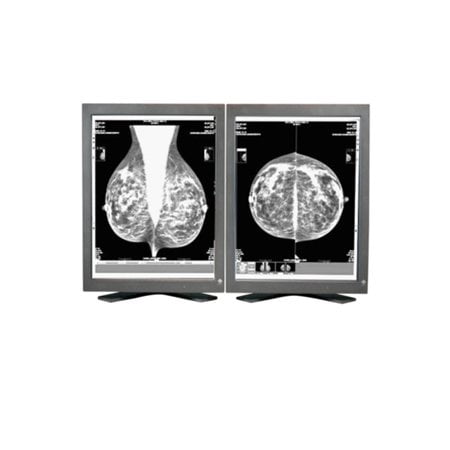 Pair (x2) Eizo Radiforce GS520 5MP Grayscale Digital Mammography Diagnostic Monitors