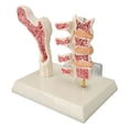 thumbnail image 1 of Osteoporosis Model, Osteoporosis Spine Model   for Clinical Teaching, 1 of 8