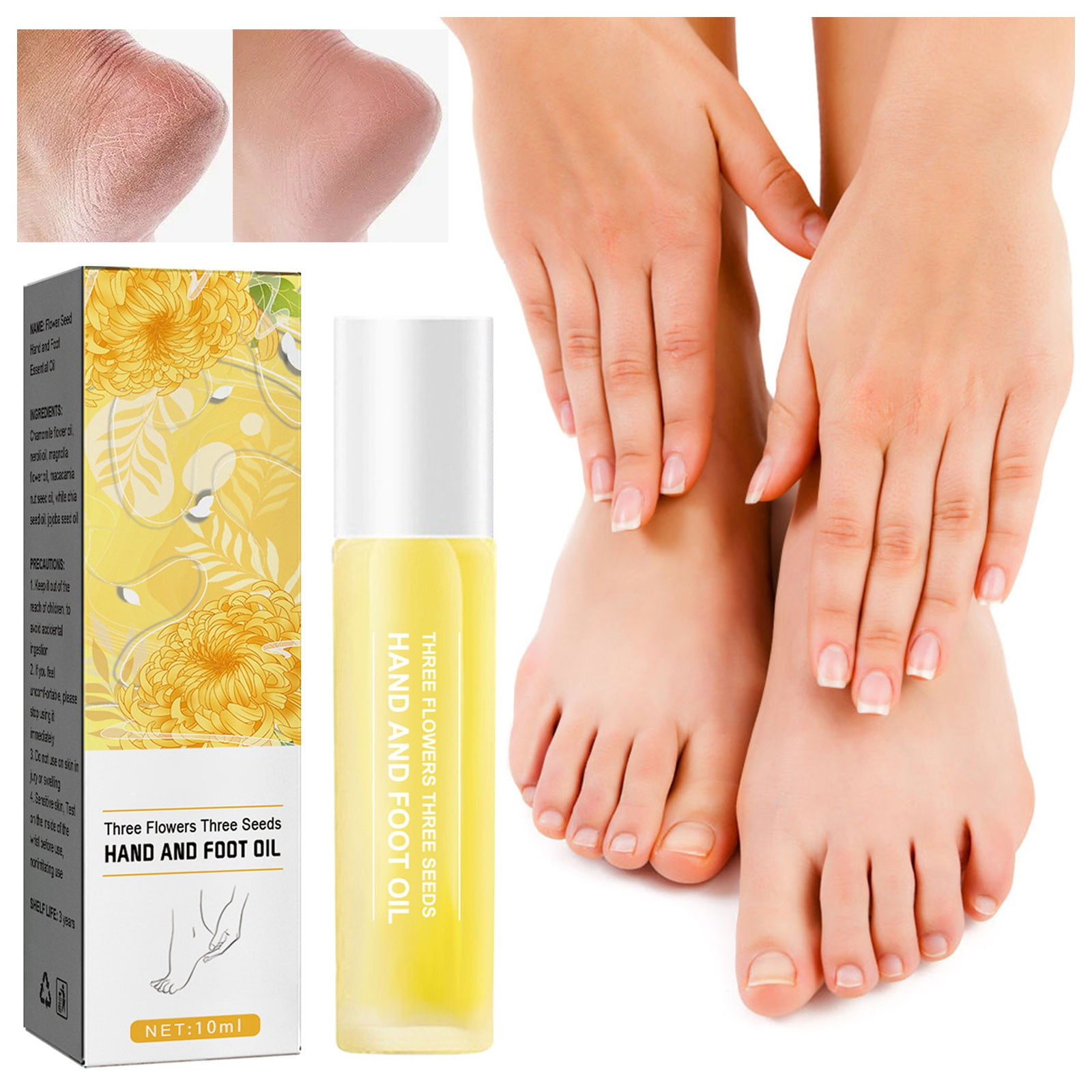 niuredltd-three-flowers-and-three-hand-and-foot-oil-itchy-feet-hands