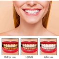thumbnail image 4 of Of Toothbrush Oral Decontamination Cleaning Remove Yellow Teeth Tooth Staining Brightening Whiteni, 4 of 5