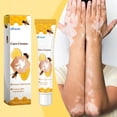 thumbnail image 3 of 20g VitiGO Bee Treatment Cream - 50% OFF, 3 of 8