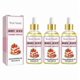 thumbnail image 1 of Strawberry Scented Massage Oil for Dry Skin, Firm Moisturizing Body Oil with Essential Oils, 1-3PCS, 1 of 5