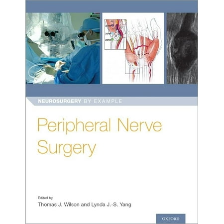 UPC: 9780190617127 | Neurosurgery by Example: Peripheral Nerve Surgery (Paperback)