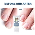 thumbnail image 3 of Nail Biting Treatment for Kids, Nail Biting Prevention for Kids & Adults, 100% Natural Plants, Bitter Taste Thumb Sucking Deterrent, Anti-Nail Biting, 3 of 5