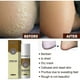 thumbnail image 5 of Anti Fungal Infections Fungus Combat Feet Spray Athlete's Foot Spray, 5 of 5