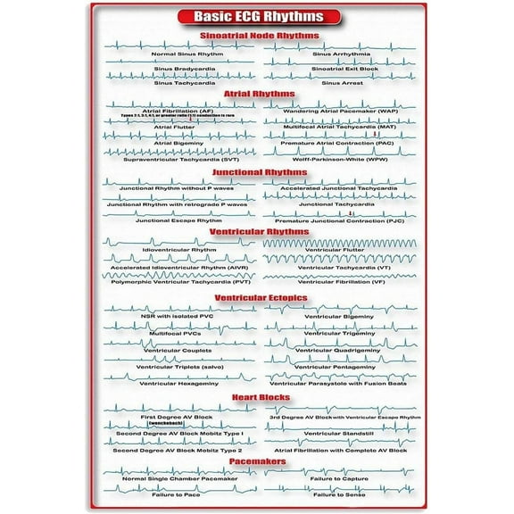 Basic Ecg Rhythms Infographic Metal Sign Wall Decor Cardiology Study Guide Poster Cardiologist Metal Tin Sign 8x12 Inch